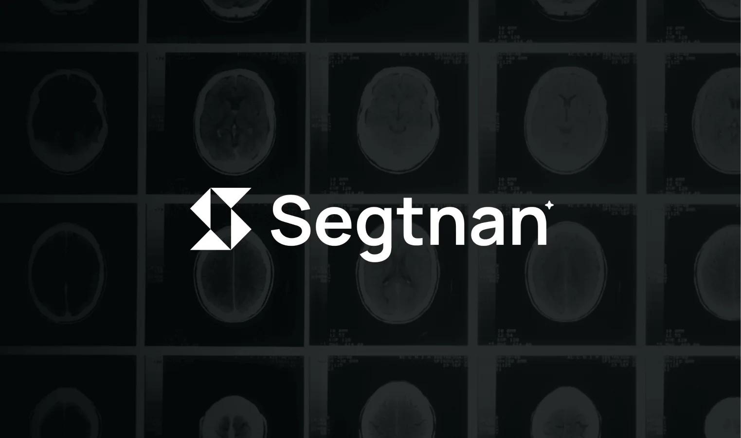 Segtnan